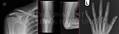 X-ray images of shoulder, arm, and hand showing medical expertise